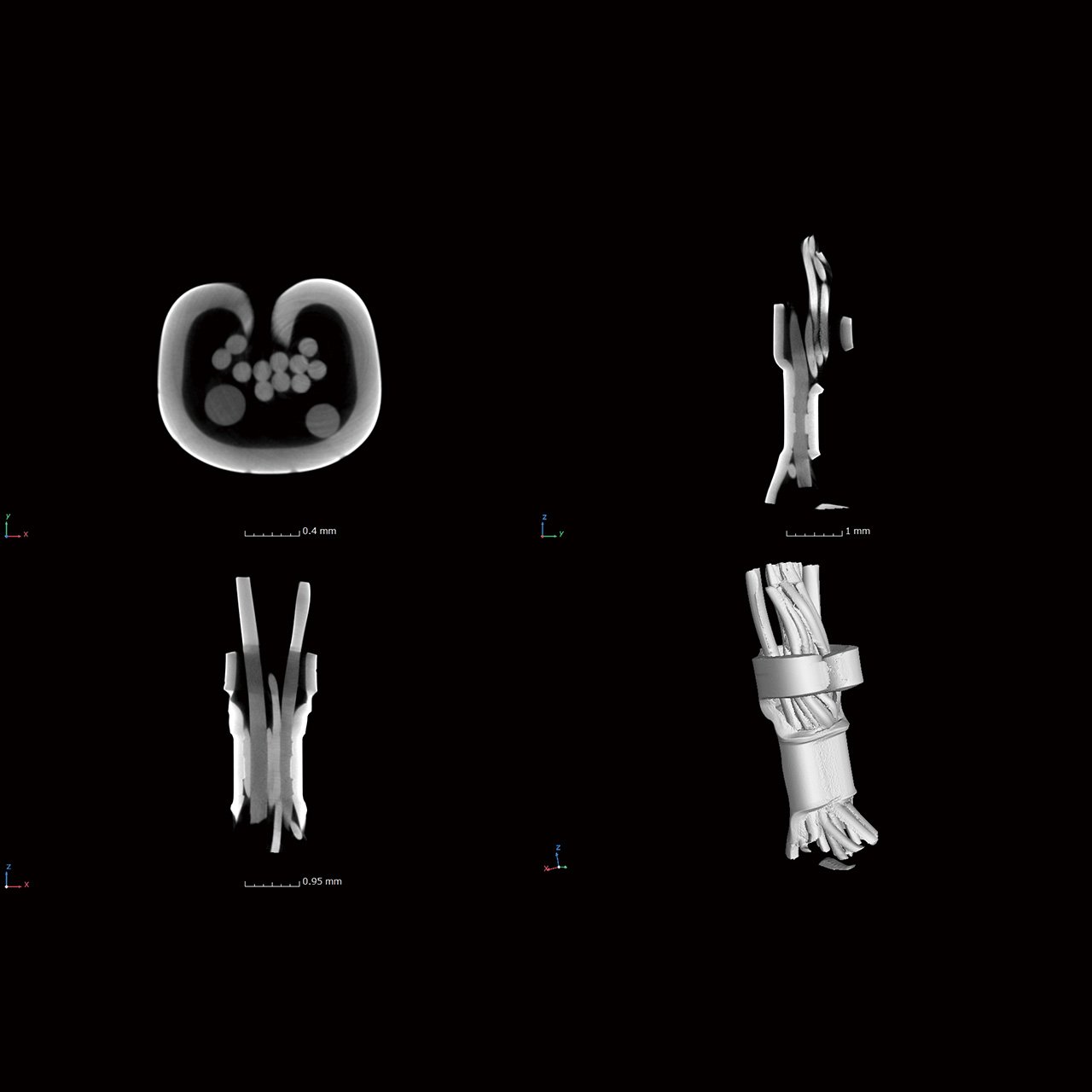 Cable (tomograph of multiplanar reconstruction)