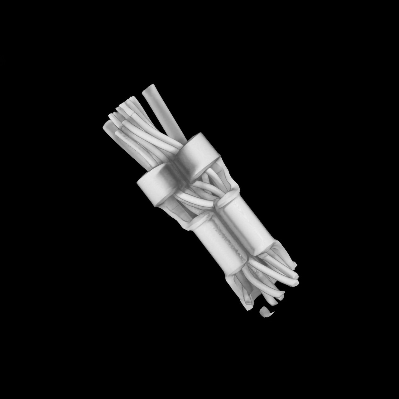 Cable (tomograph of multiplanar reconstruction)